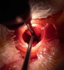 Endoscopy Unit